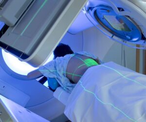 Read more about the article Radiation Therapy: Management of Acute and Long-Term Toxicities