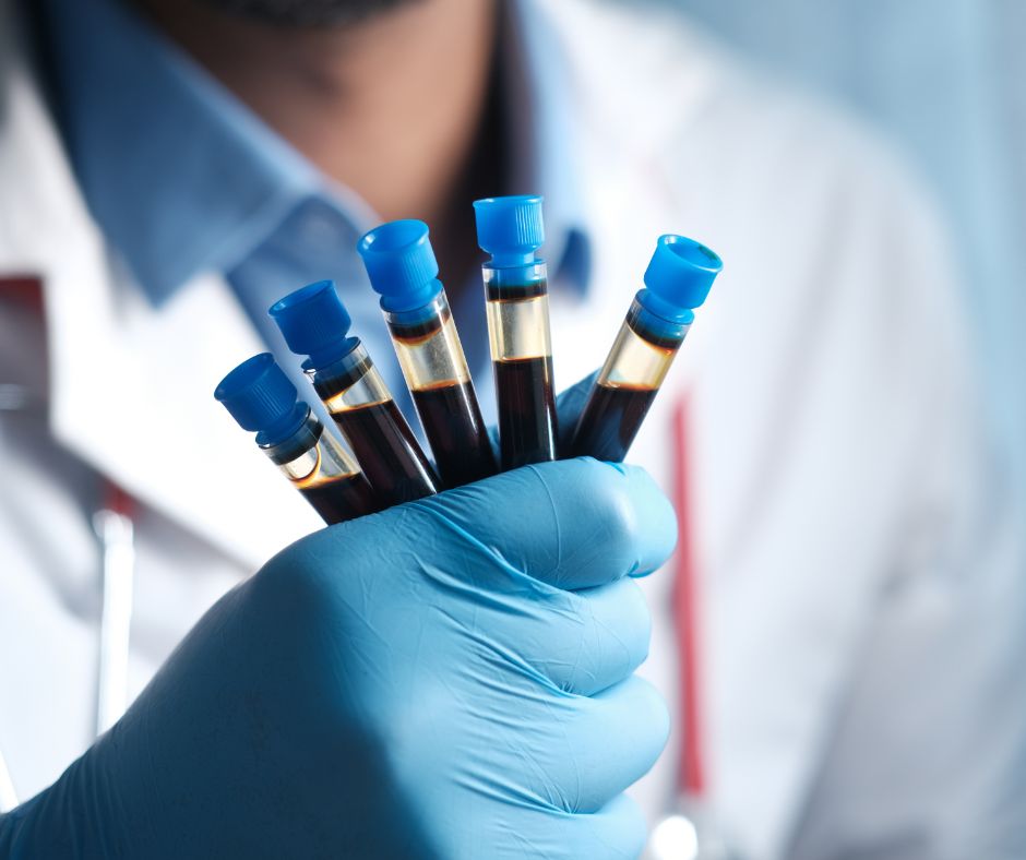 Blood Samples